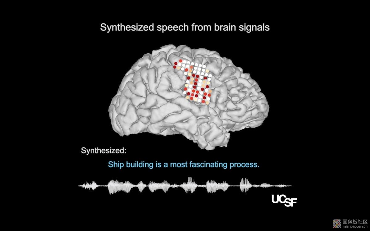 voix-synthetique-cerveau-5.jpg